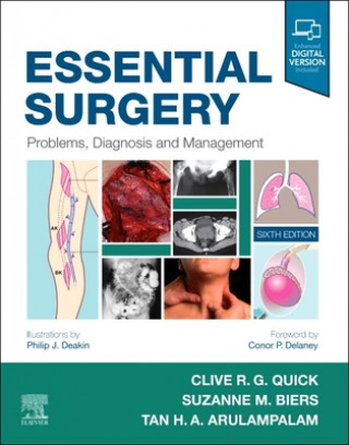 Книга Essential Surgery 