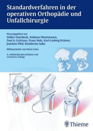 Kniha Standardverfahren in der operativen Orthopädie und Unfallchirurgie Andreas Wentzensen
