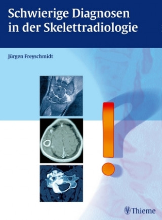 Kniha Schwierige Diagnosen in der Skelettradiologie Jürgen Freyschmidt