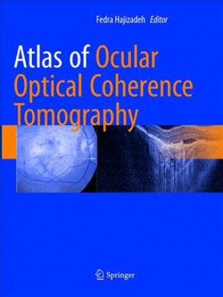 Könyv Atlas of Ocular Optical Coherence Tomography Fedra Hajizadeh