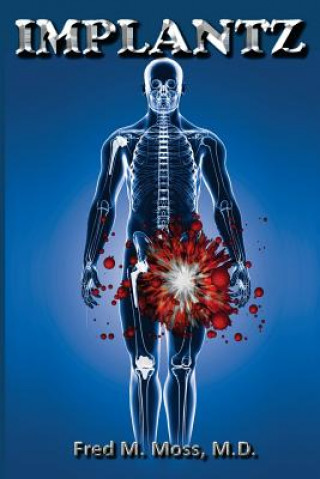 Book Implantz Dr Fred M Moss