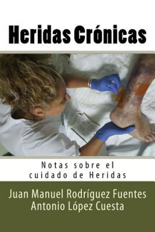 Kniha Heridas Cronicas: Notas sobre el cuidado de Heridas Juan Manuel Rodriguez Fuentes
