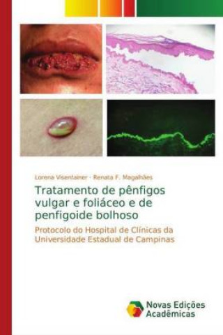Книга Tratamento de pênfigos vulgar e foliáceo e de penfigoide bolhoso Lorena Visentainer