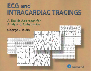 Kniha ECG and Intracardiac Tracings George J. Klein