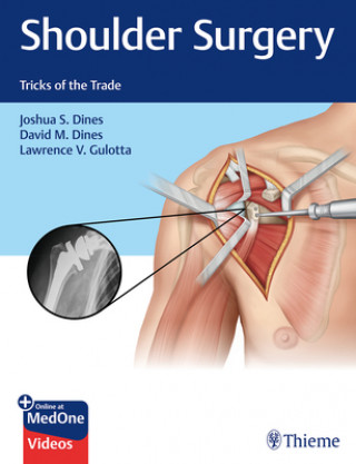 Könyv Shoulder Surgery Joshua Dines