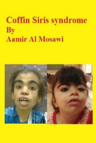 Livro Coffin Siris syndrome: Clinical genetics Aamir Jalal Al Mosawi