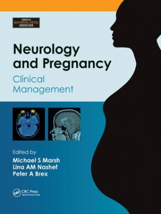 Książka Neurology and Pregnancy 