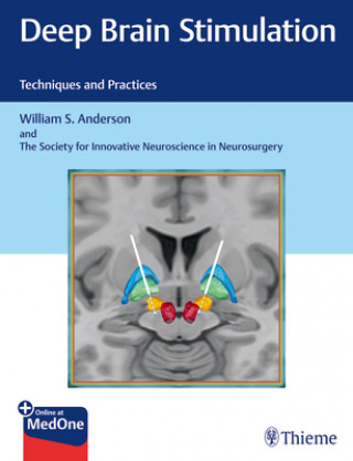 Kniha Deep Brain Stimulation William Anderson