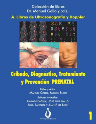 Carte Cribado, Diagnóstico, Tratamiento Y Prevención Prenatal Miguel Ruoti