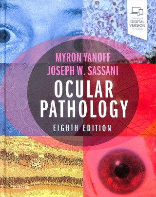 Könyv Ocular Pathology Myron Yanoff