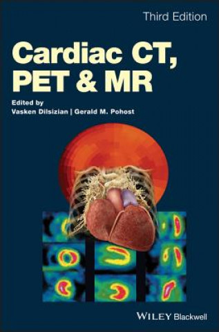 Книга Cardiac CT, PET and MR, Third Edition Vasken Dilsizian