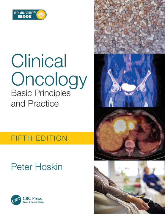 Könyv Clinical Oncology Hoskin