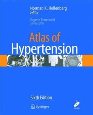 Carte Atlas of Hypertension Norman K. Hollenberg