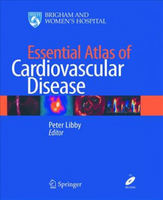 Kniha Essential Atlas of Cardiovascular Disease Peter Libby