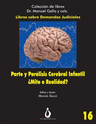 Kniha Parto Y Parálisis Cerebral Infantil. ?mito O Realidad?: Una Relación Cada Vez Menos Posible Jose Bajo Arenas