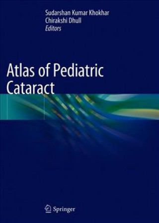 Kniha Atlas of Pediatric Cataract Sudarshan Kumar Khokhar