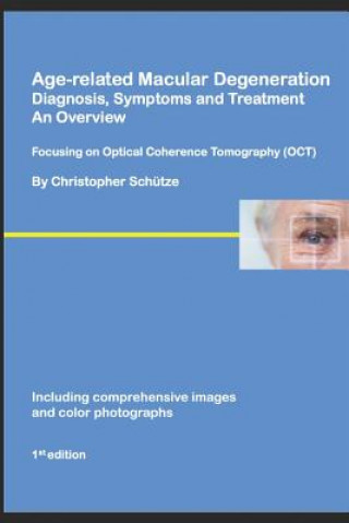 Kniha Age-related Macular Degeneration, Diagnosis, Symptoms and Treatment, An Overview: Focusing on Optical Coherence Tomography Sch