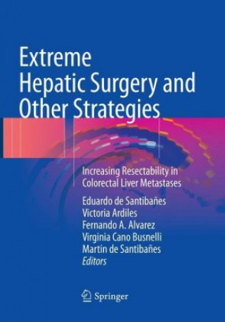 Book Extreme Hepatic Surgery and Other Strategies Eduardo de Santibañes