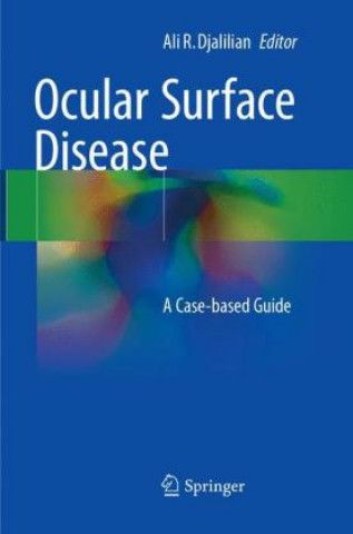 Book Ocular Surface Disease Ali R. Djalilian