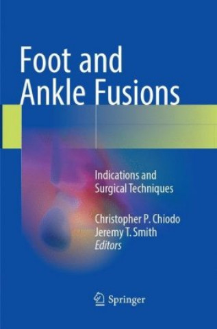 Könyv Foot and Ankle Fusions Christopher P. Chiodo