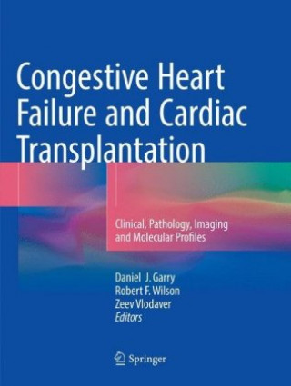 Kniha Congestive Heart Failure and Cardiac Transplantation Daniel J. Garry