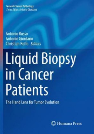 Carte Liquid Biopsy in Cancer Patients Antonio Russo