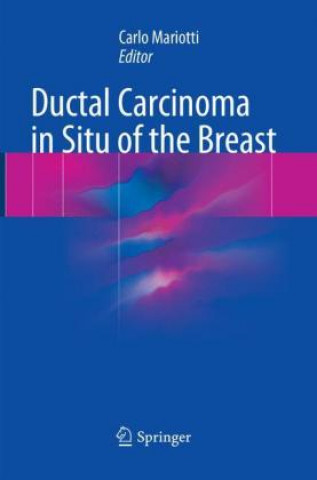 Book Ductal Carcinoma in Situ of the Breast Carlo Mariotti