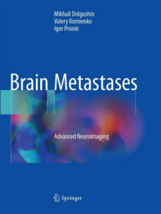 Könyv Brain Metastases Mikhail Dolgushin