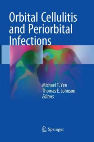 Könyv Orbital Cellulitis and Periorbital Infections Michael T. Yen