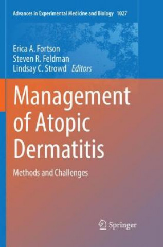 Kniha Management of Atopic Dermatitis Steven R. Feldman
