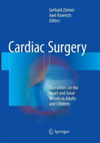 Kniha Cardiac Surgery Gerhard Ziemer