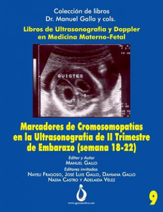 Kniha Marcadores Cromosomopatías En La Ultrasonografia de II Trimestre de Embarazo (Semana 18-22) Jose Padilla