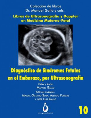 Kniha Diagnostico de Síndromes Fetales En El Embarazo, Por Ultrasonografia Jose Padilla