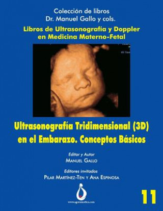 Kniha Ultrasonografia Tridimensional En El Embarazo (3d). Conceptos Básicos Jose Padilla