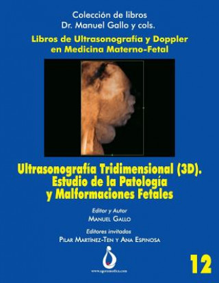 Carte Ultrasonografía Tridimensional (3d). Estudio de la Patología Y Malformaciones Fetales Jose Padilla