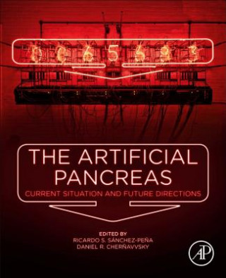 Carte Artificial Pancreas Riccardo S. Sanchez-Pena