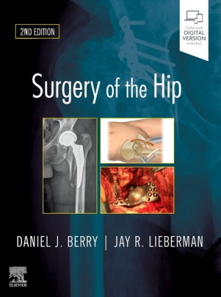 Kniha Surgery of the Hip Berry