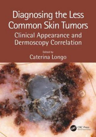 Könyv Diagnosing the Less Common Skin Tumors 