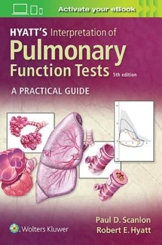 Könyv Hyatt's Interpretation of Pulmonary Function Tests Paul D. Scanlon