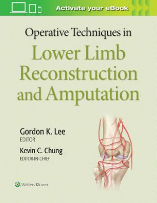 Könyv Operative Techniques in Lower Limb  Reconstruction and Amputation Kevin Chung