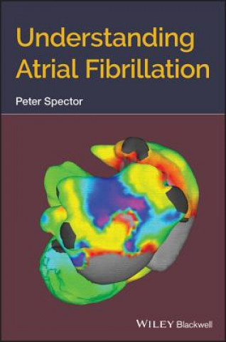 Kniha Understanding Atrial Fibrillation Peter Spector