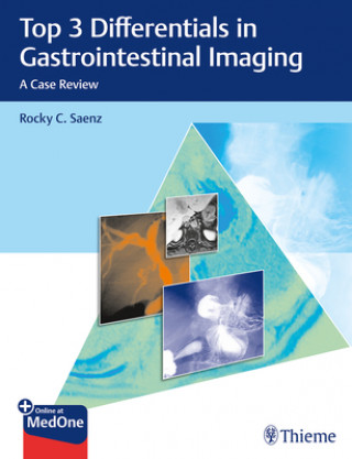Kniha Top 3 Differentials in Gastrointestinal Imaging Rocky Saenz