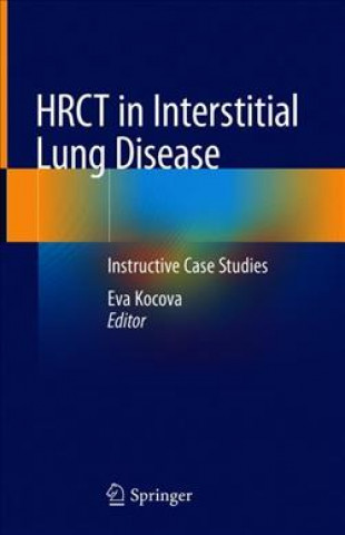 Kniha HRCT in Interstitial Lung Disease Eva Kocova