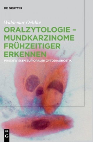 Buch Oralzytologie - Mundkarzinome fruhzeitiger erkennen Waldemar Oehlke