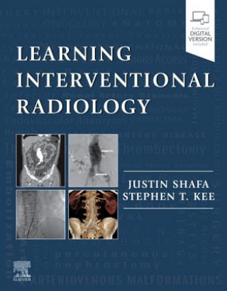 Kniha Learning Interventional Radiology Justin Shafa