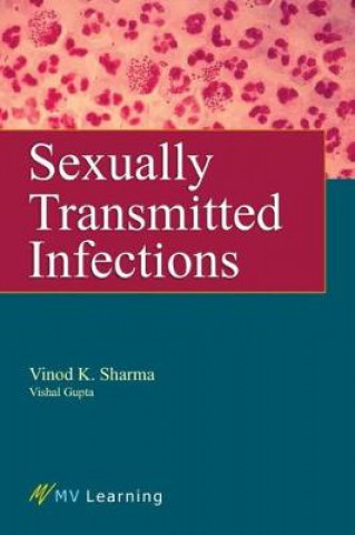 Kniha Sexually Transmitted Infections MV Learning