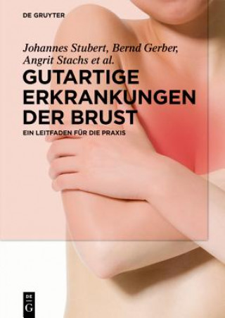 Carte Gutartige Erkrankungen Der Brust Johannes Stubert