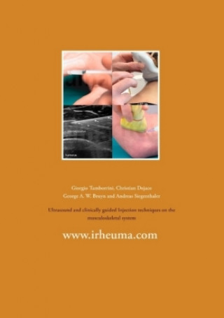 Книга Ultrasound and clinically guided Injection techniques on the musculoskeletal system Giorgio Tamborrini