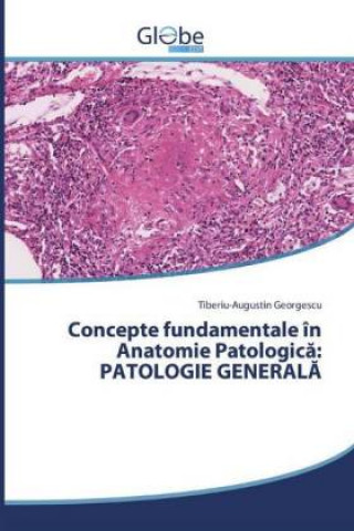 Kniha Concepte fundamentale în Anatomie Patologic?: PATOLOGIE GENERAL? Tiberiu-Augustin Georgescu