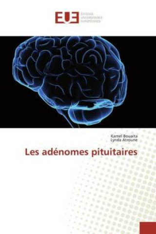 Boek Les adenomes pituitaires Kamel Bouaita